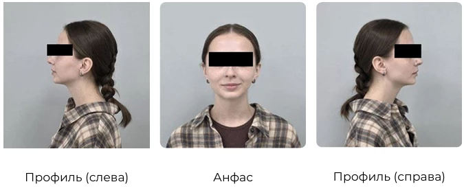 Как подготовить фото для консультации 1