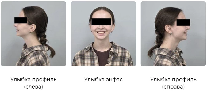 Как подготовить фото для консультации 2