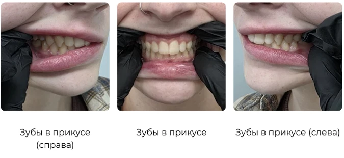 Как подготовить фото для консультации 3