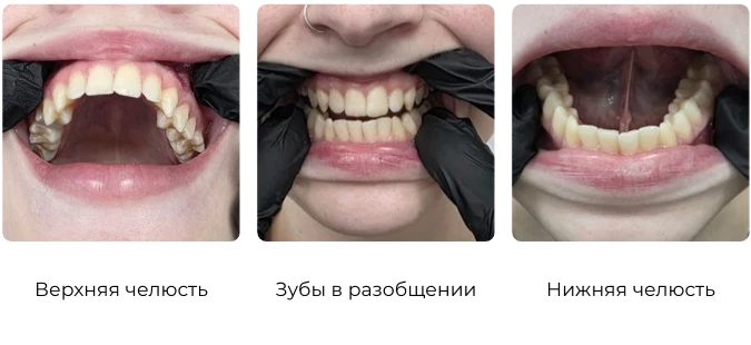 Как подготовить фото для консультации 4